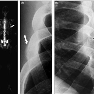 Transformer une photo en puzzle gratuitement